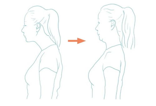 小小姿势改变，守护脊柱大健康